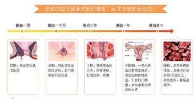 福州怎么检查便血是怎么回事